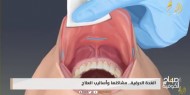 مشاكل الغدة الدرقية.. الأساب والعلاج