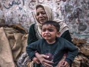 مقترح أوروبي لاستضافة الأطفال المصابين من غزة