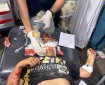 فيديو | 3 شهداء و10 مصابين جراء قصف الاحتلال شقة سكنية لعائلة اللوح غرب النصيرات