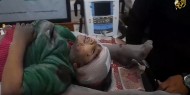فيديو | شهداء ومصابون جراء قصف الاحتلال مدرسة تؤوي نازحين بمخيم النصيرات وسط القطاع