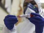 صحة غزة تسجل 50 إصابة بفيروس كورونا خلال أسبوع